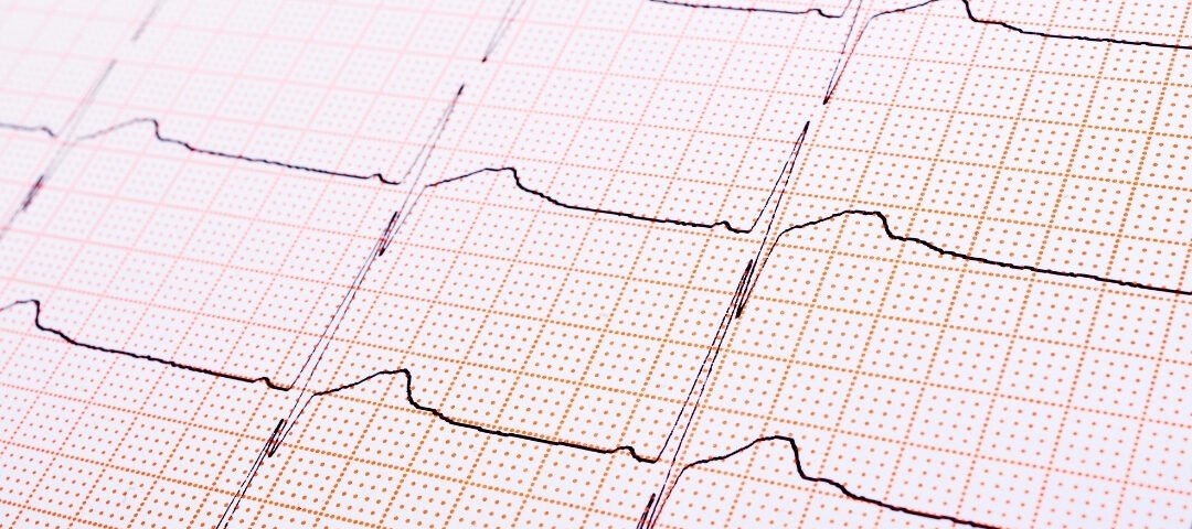 Atrioventriküler Septal Defekt (AVSD)