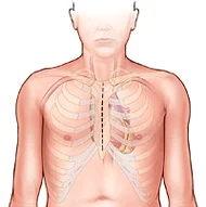 Kısmi Sternotomi